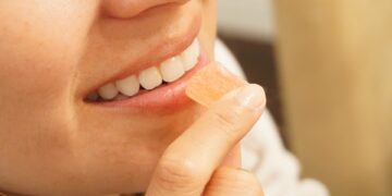 Ilningar i tänderna